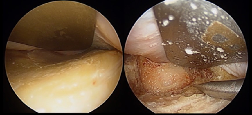 Photos from tiny camera of TED