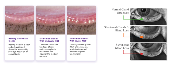 Image showing gland structure