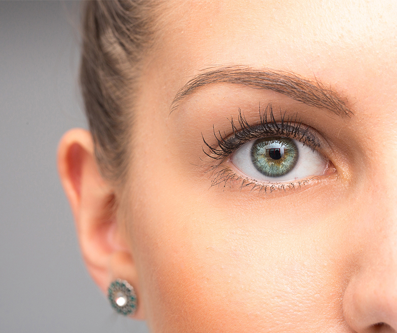 Female eye after blepharoplasty