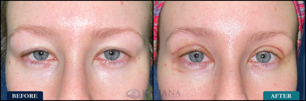 Alexandria_Before&After_Web_Layout