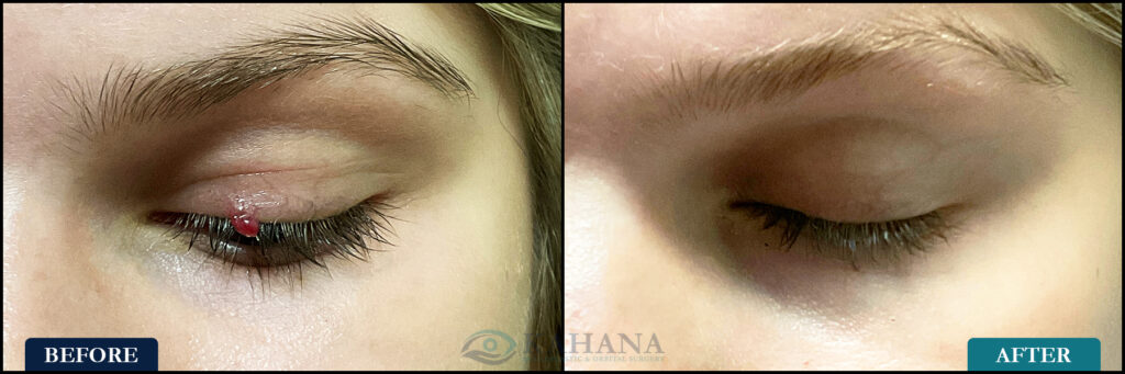 Alyssa_Before&After_Web_Layout