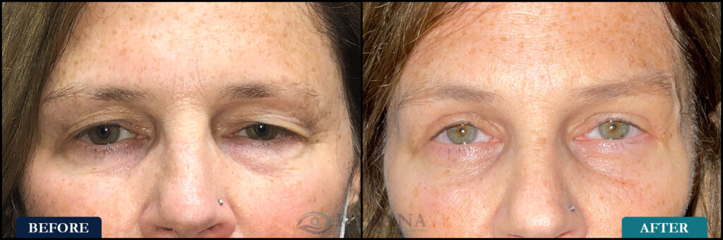 Amy_Before&After_Web_Layout