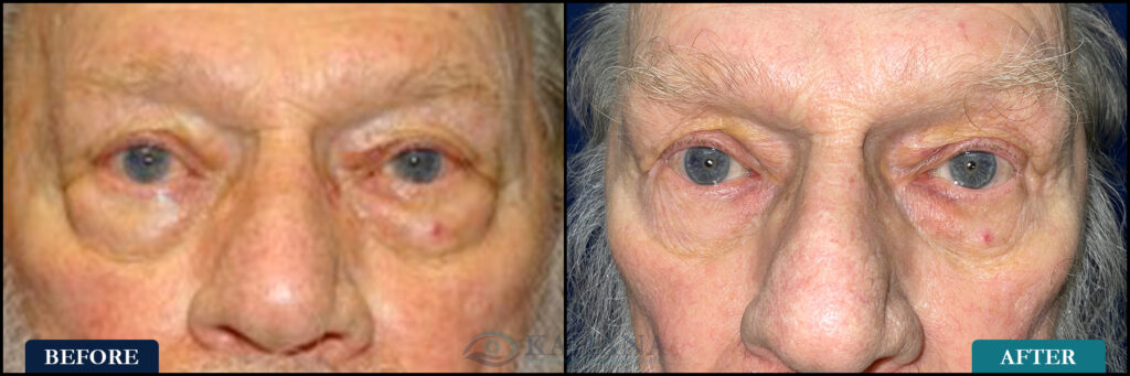 Bernhart_Before&After_Web_Layout