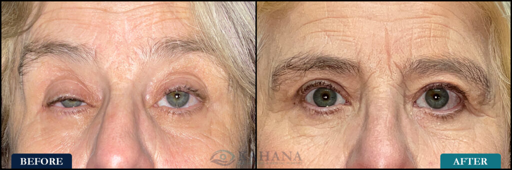 Carolyn_Before&After_Web_Layout