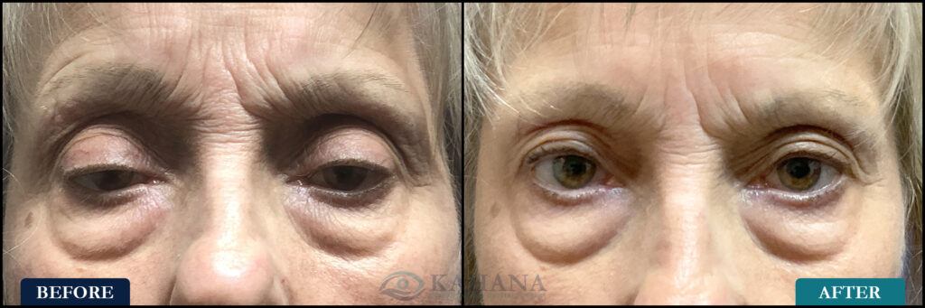 Constance_Before&After_Web_Layout