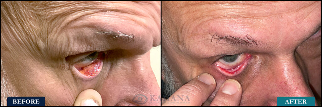 David_Before&After_Web_Layout