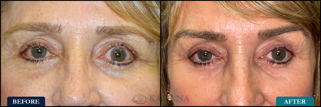 Dawn_Before&After_Web_Layout