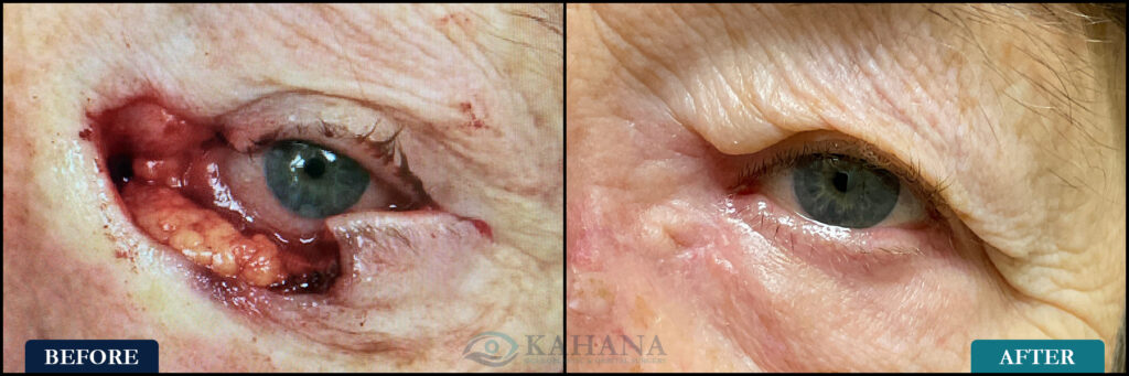 Debbie_Before&After_Web_Layout