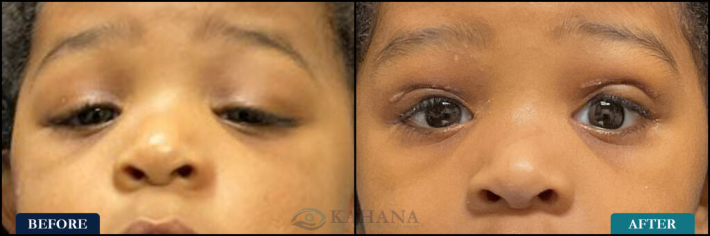 Denym_Before&After_Web_Layout