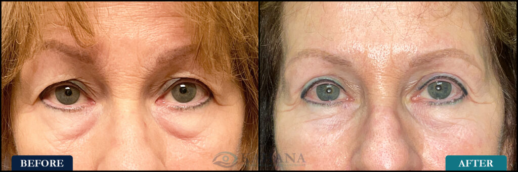 Diane_Before&After_Web_Layout