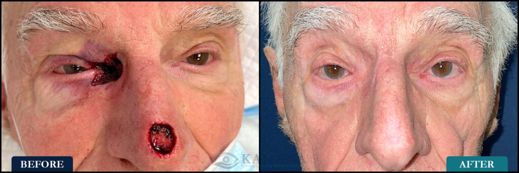 George_Before&After_Web_Layout