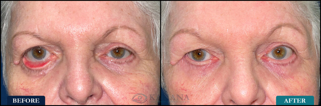 Gloria_Before&After_Web_Layout