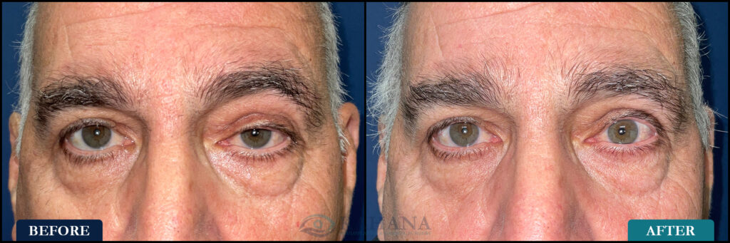 James_Before&After_Web_Layout