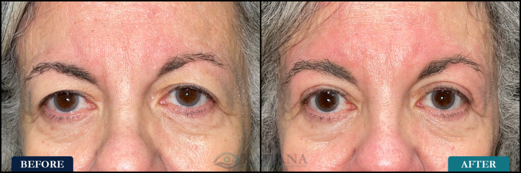 JoAnn_Before&After_Web_Layout