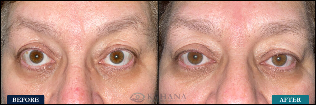 Jo_Before&After_Web_Layout