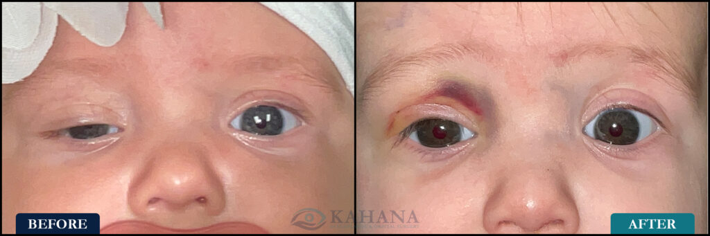 Kora_Before&After_Web_Layout