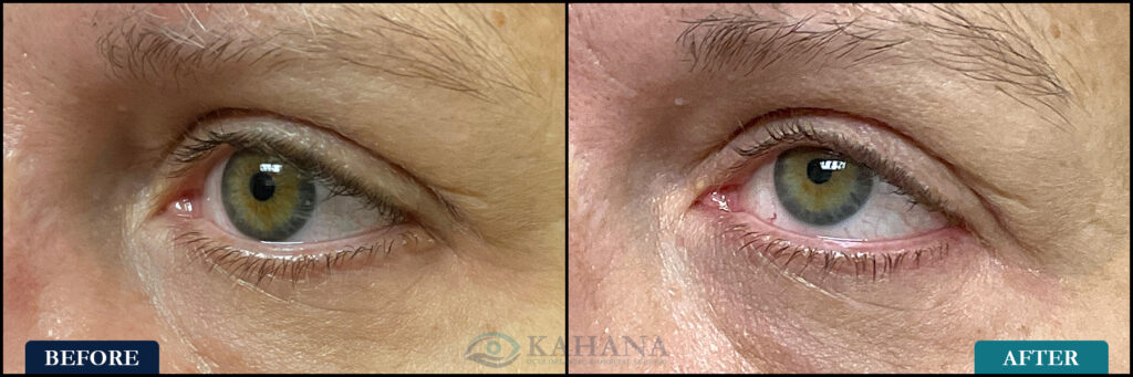 Kyla_Before&After_Web_Layout