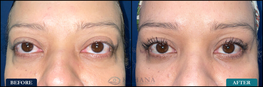 Maira_Before&After_Web_Layout