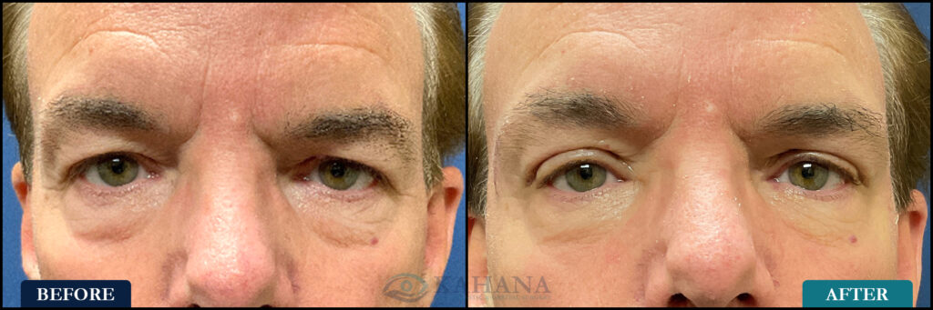 Michael_Before&After_Web_Layout