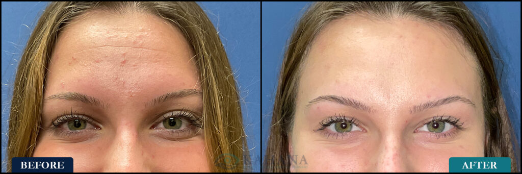 OliviaSmile_Before&After_Web_Layout