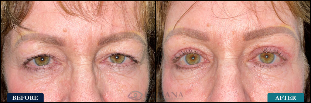 Pamela_Before&After_Web_Layout