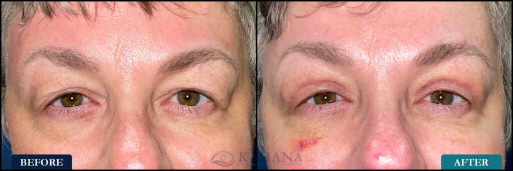 Paula_Before&After_Web_Layout