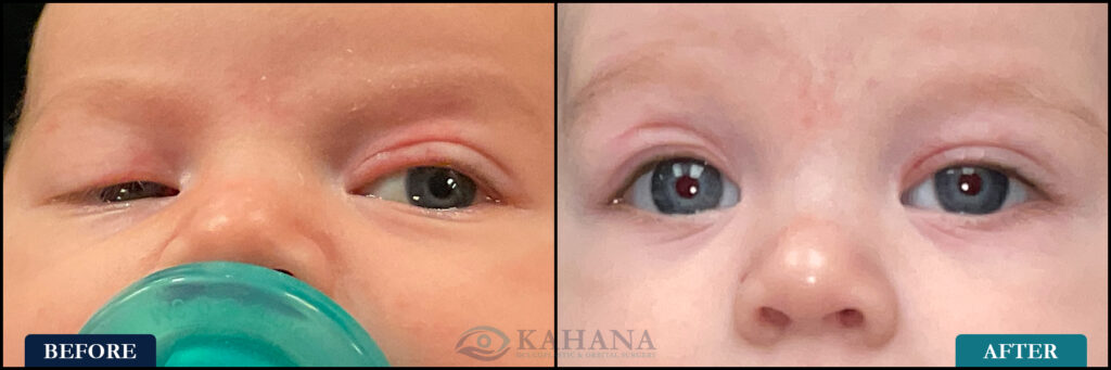 Paxton_Before&After_Web_Layout