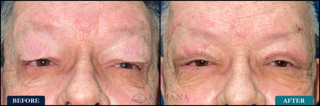 Randy_Before&After_Web_Layout