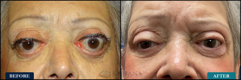 Rita_Before&After_Web_Layout