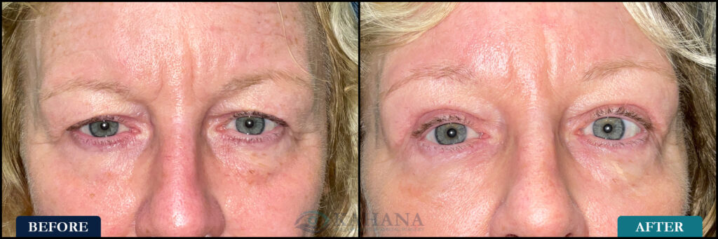 Sandra_Before&After_Web_Layout