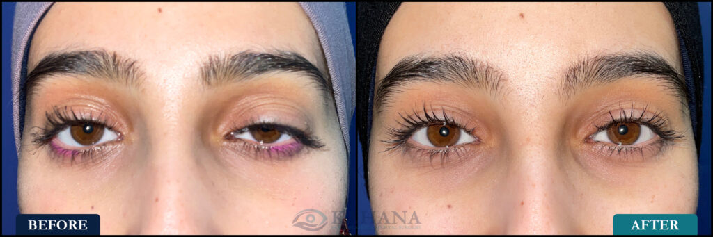 Shereen_Before&After_Web_Layout