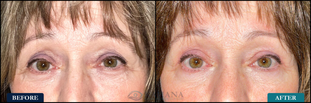 Susan_Before&After_Web_Layout