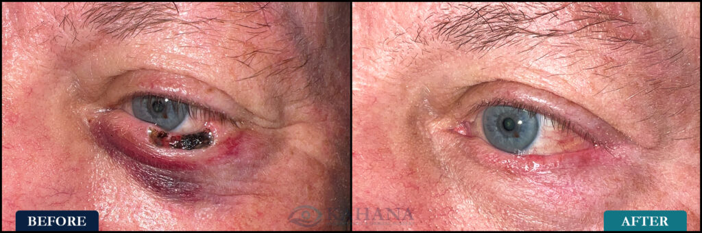 Thomas_Before&After_Web_Layout