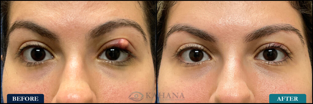 Valerie_Before&After_Web_Layout