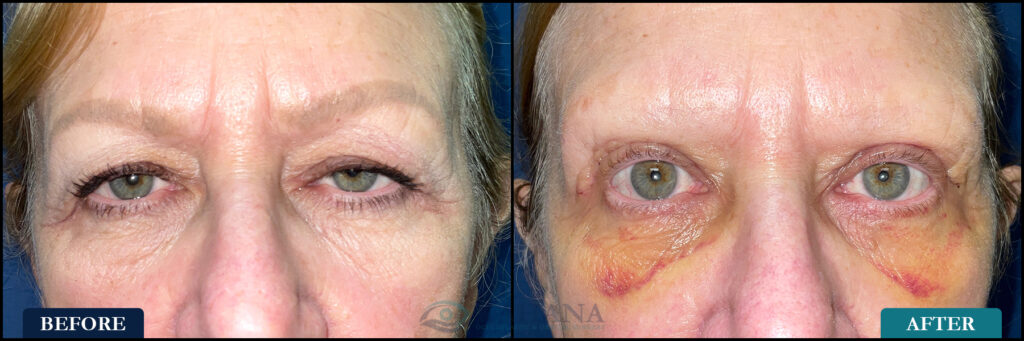 Wendy_Before&After_Web_Layout