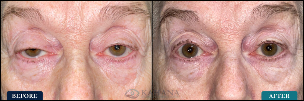 Beverly_Before&After_Web_Layout