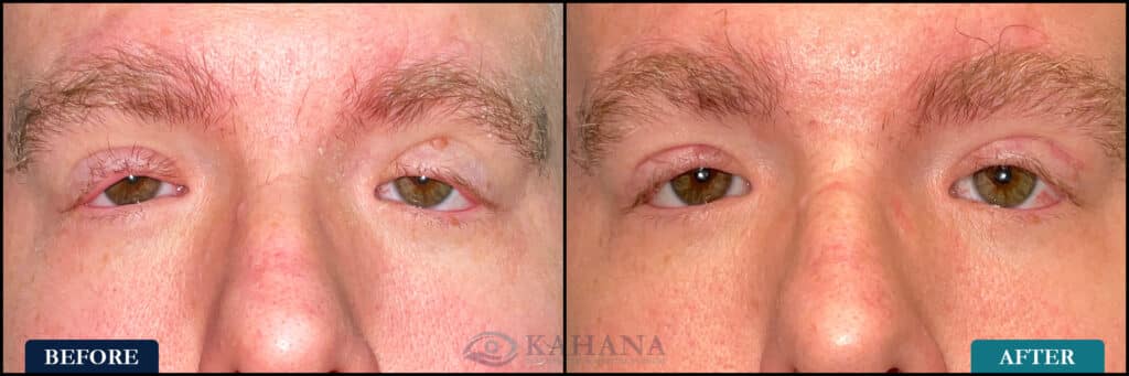 Case_Before&After_Web_Layout