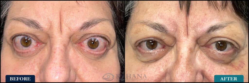 Charlou_Before&After_Web_Layout