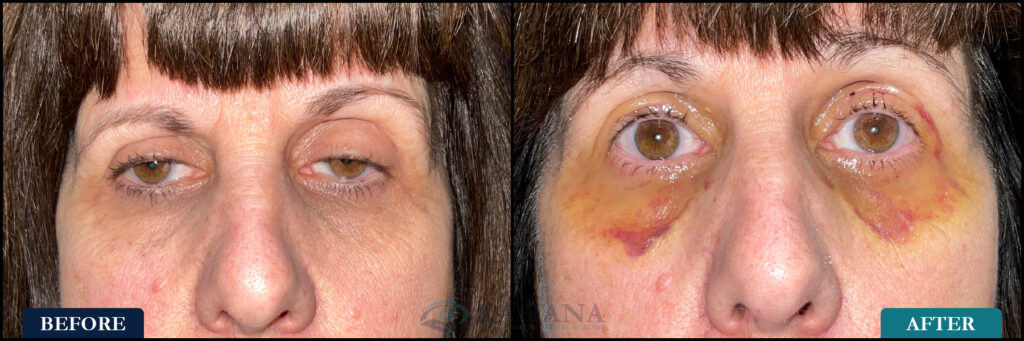 Colleen_Before&After_Web_Layout