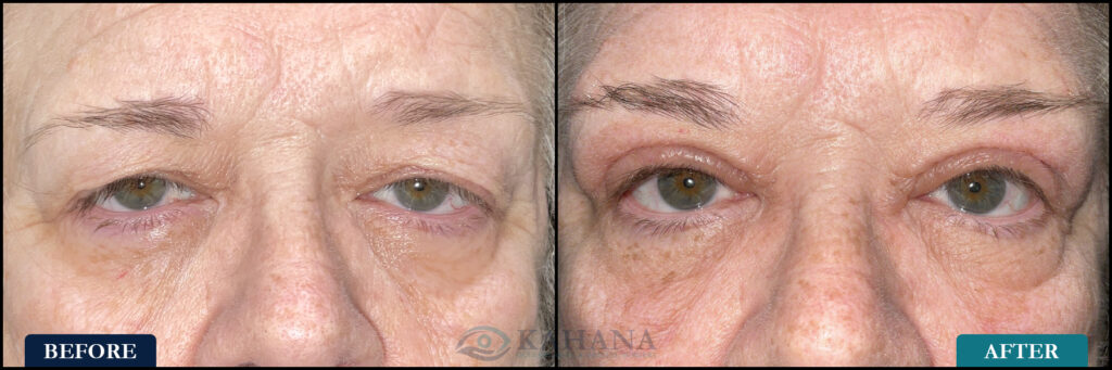 Debra_Before&After_Web_Layout