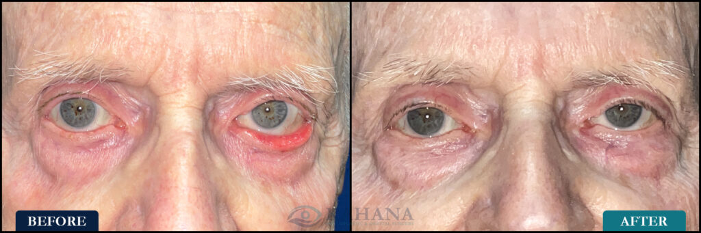 Donald_Before&After_Web_Layout