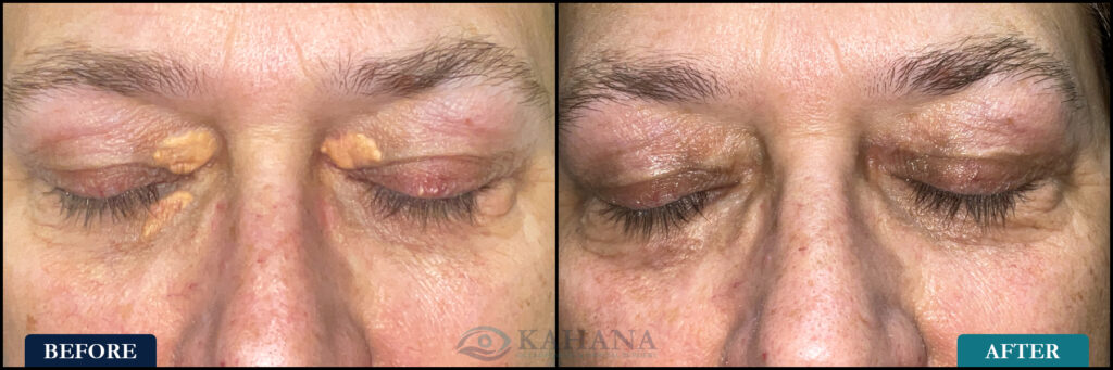 Joanne_Before&After_Web_Layout